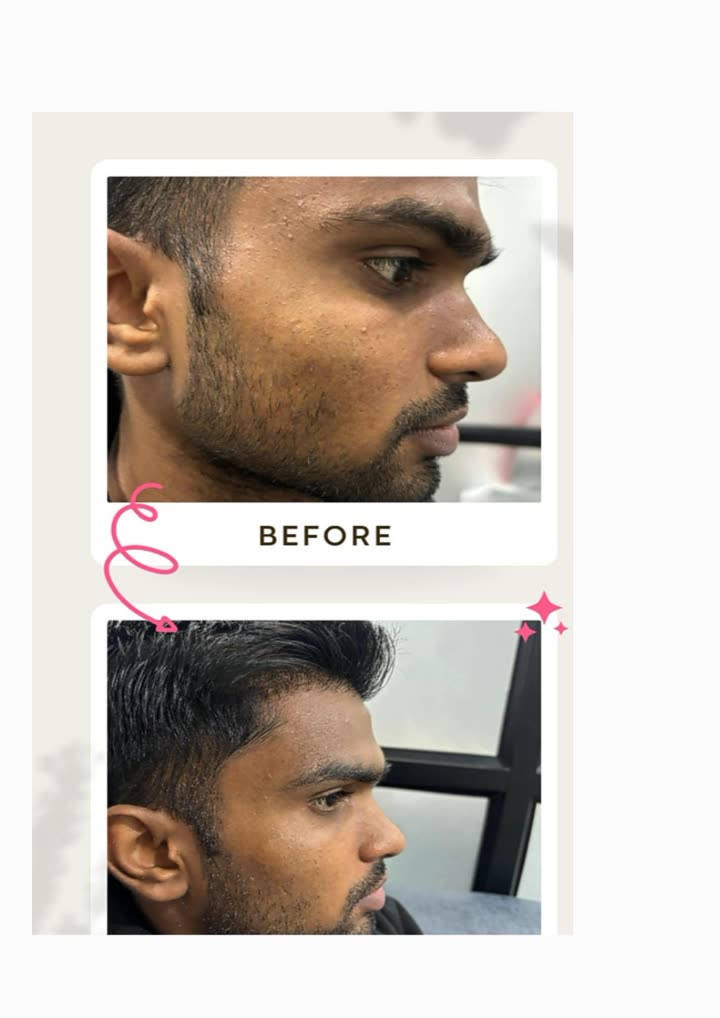 Before and after skin treatment result at Aesthetic Derm Clinic