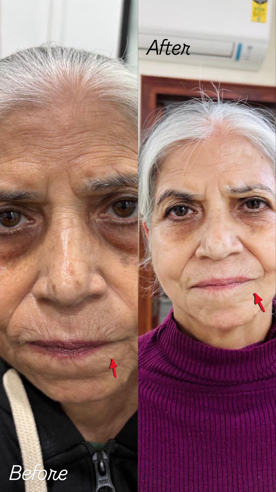 Before and after results at Aesthetic Derm Clinic