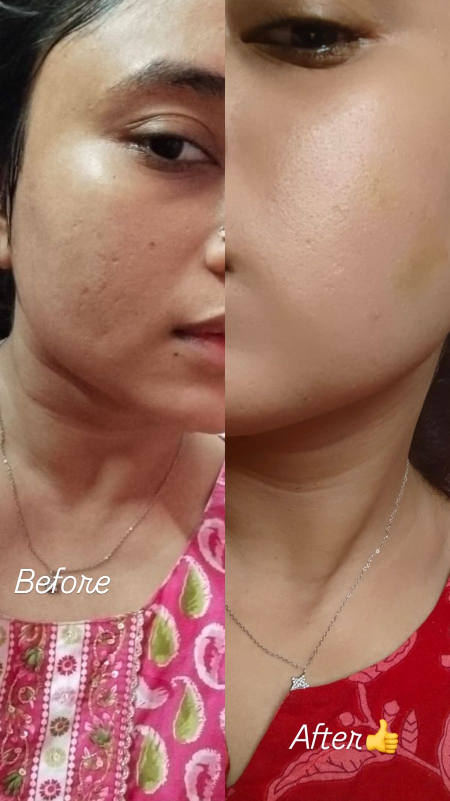 Before and after results at Aesthetic Derm Clinic