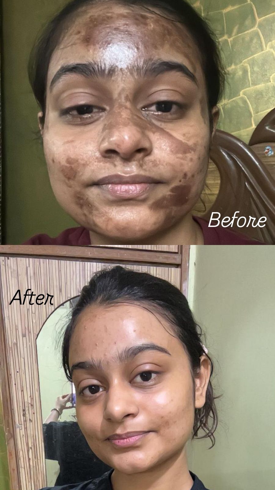 Before and after results at Aesthetic Derm Clinic