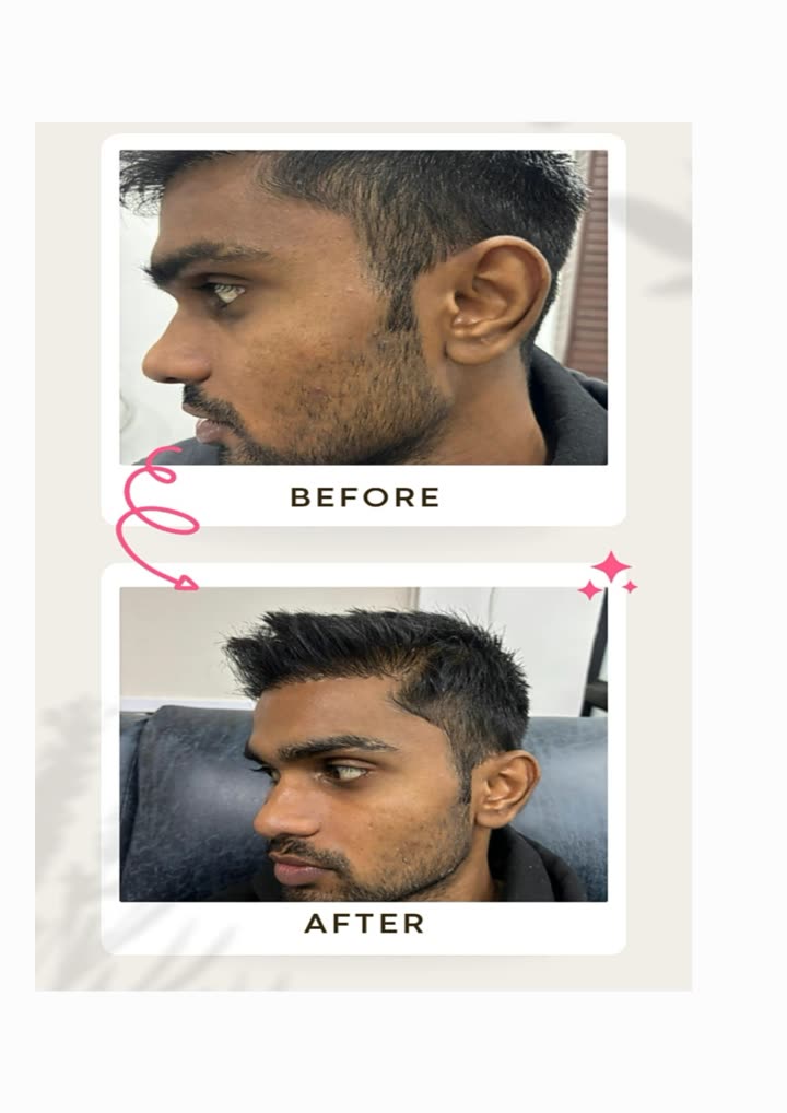 Before and after face treatment result at Aesthetic Derm Clinic