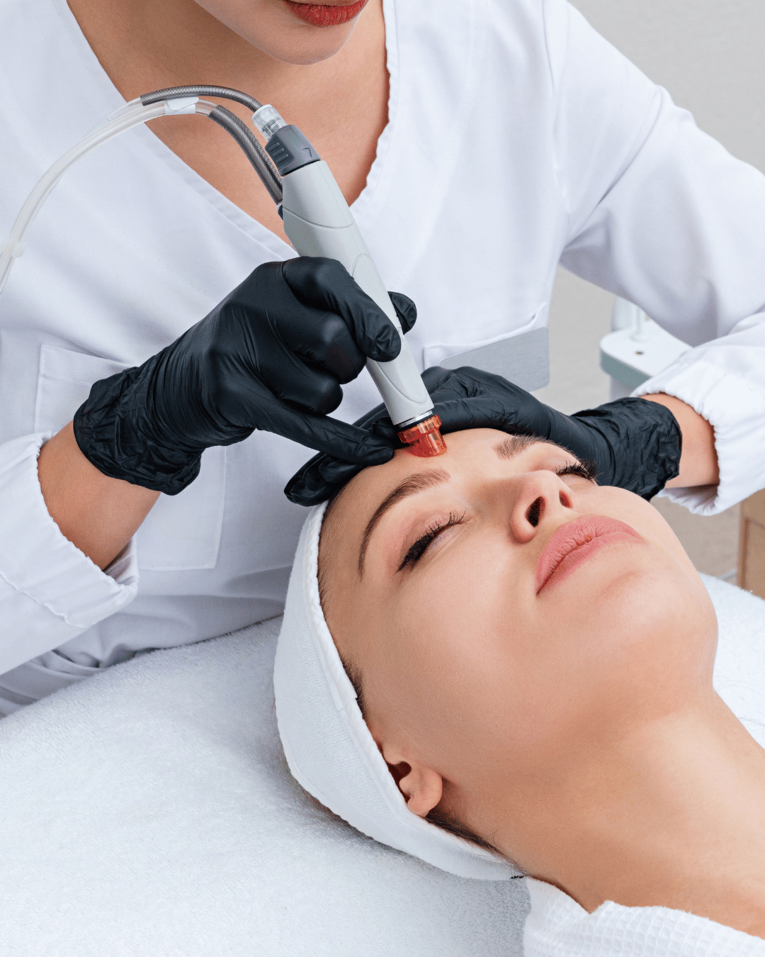 Best Acne Treatments in Delhi