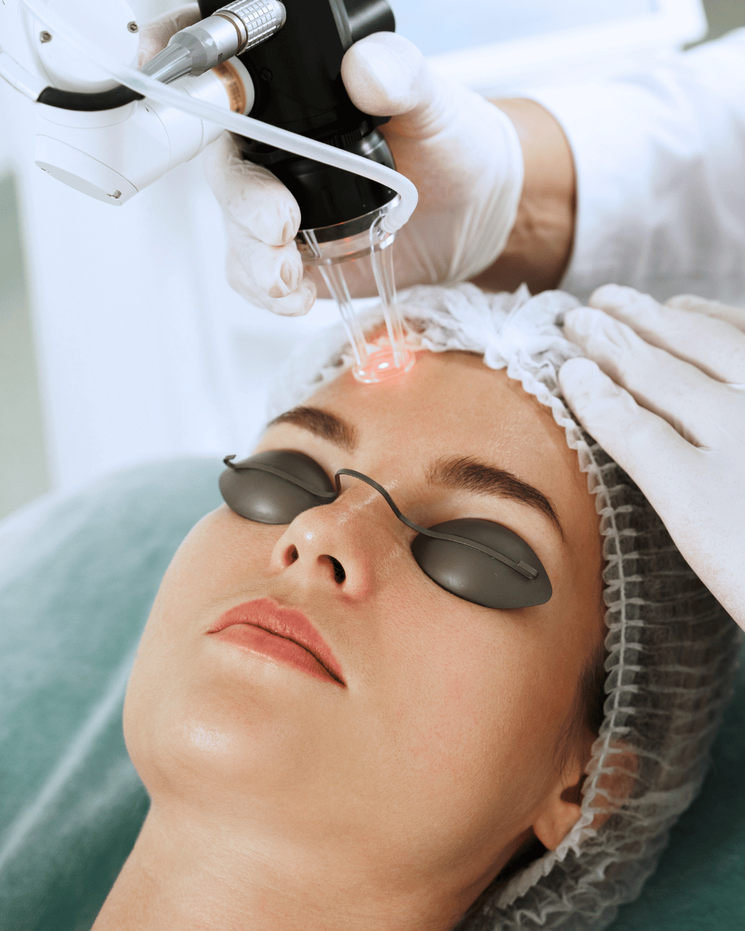 Pigmentation & acne management